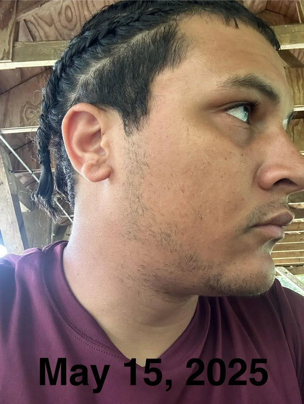 Before — Anthony M.