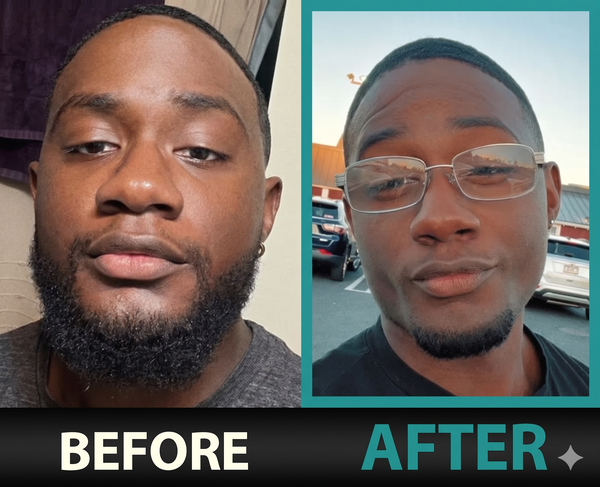 Before — Mike H.