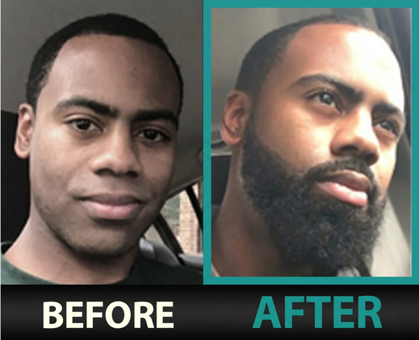 Before — Jordan K.