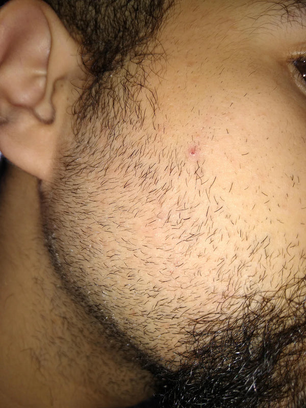 Before — James L.