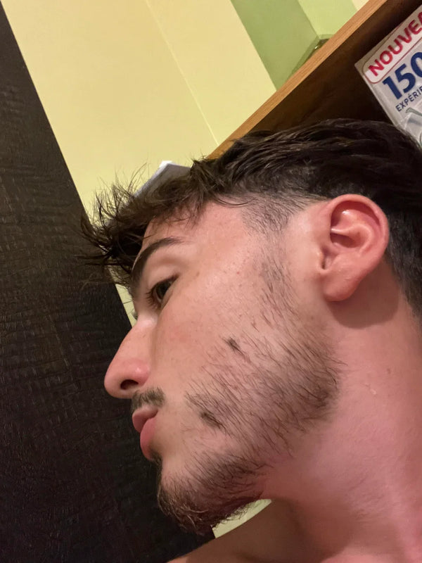 Before — Marcus T.
