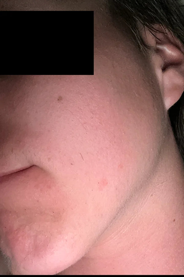 Before — Carlos V.