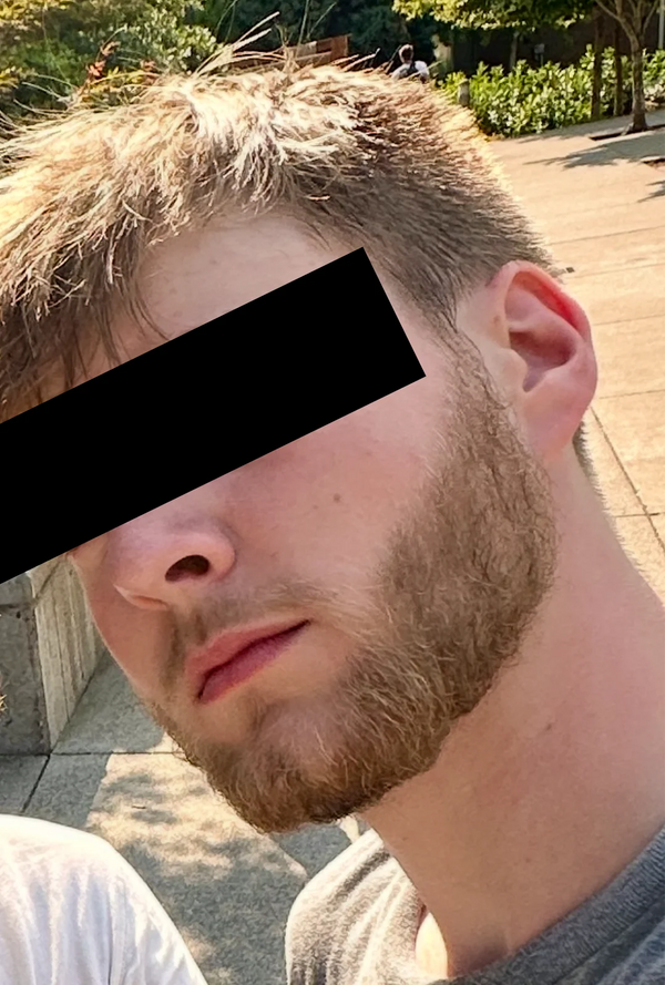 After — Carlos V.