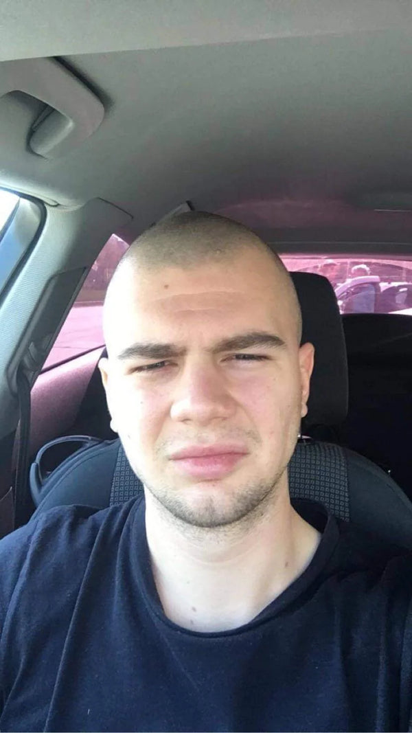Before — Adam W.