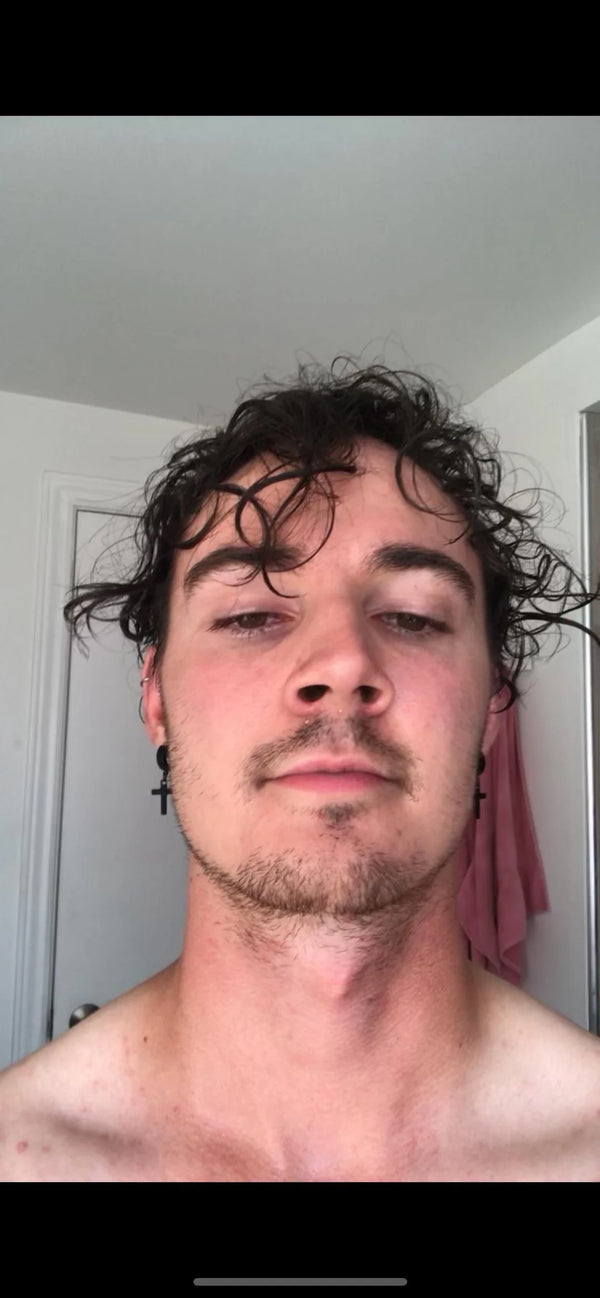 Before — Daniel R.