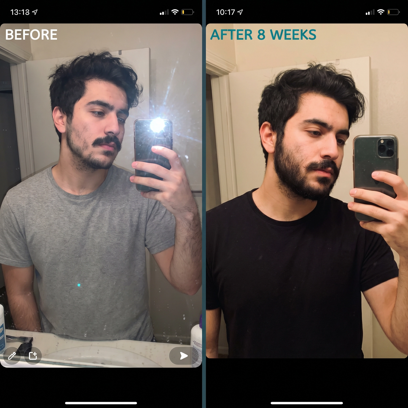 ApexMane - Beard Growth Protocol